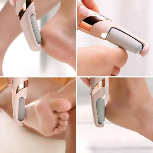 Electronic Cordless Pedicure Callus Remover: Smooth Dead Skin Polishing Tool