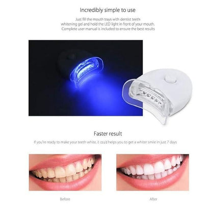 Sensitive Teeth Whitening Kit | Gentle & Effective Stain Removal System